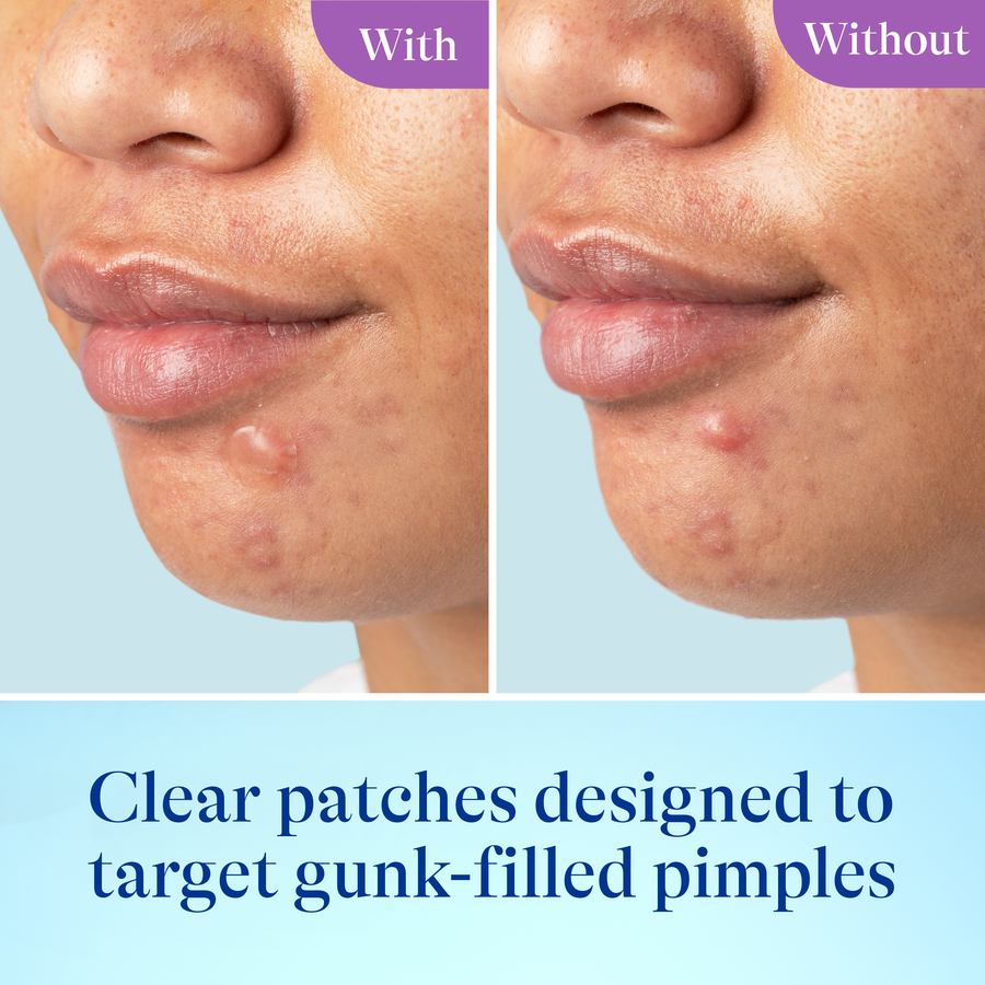 Power Patch Skin Restore