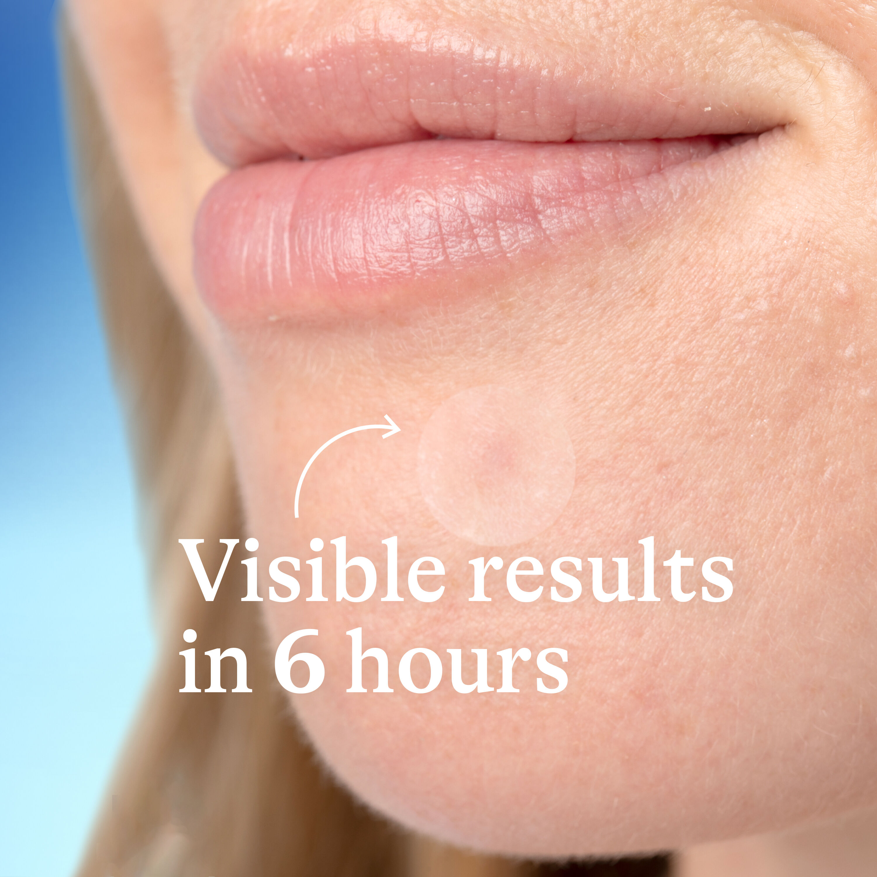 Power Patch Fast Fix