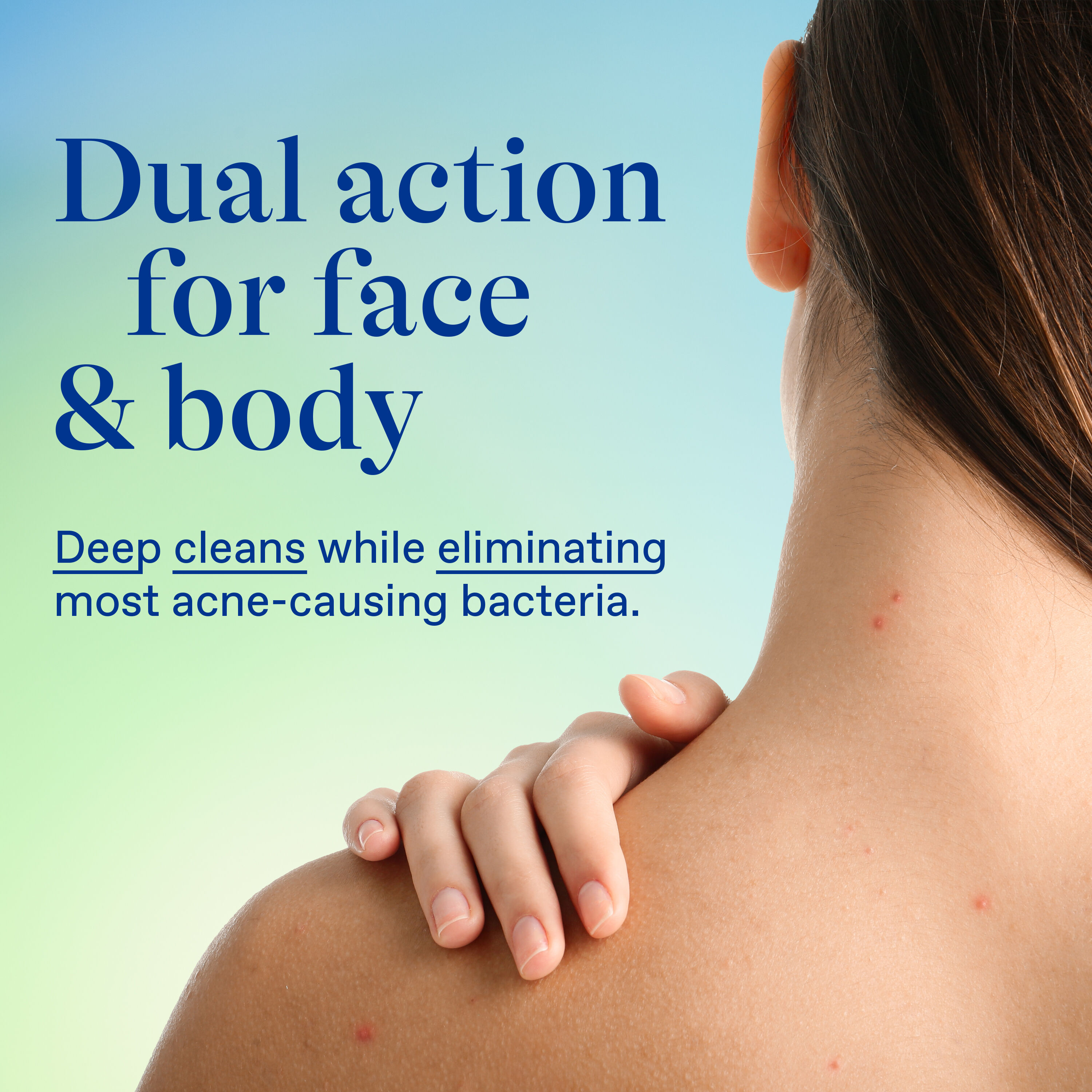 10% Benzoyl Peroxide Maximum Strength Acne Foaming Cleanser